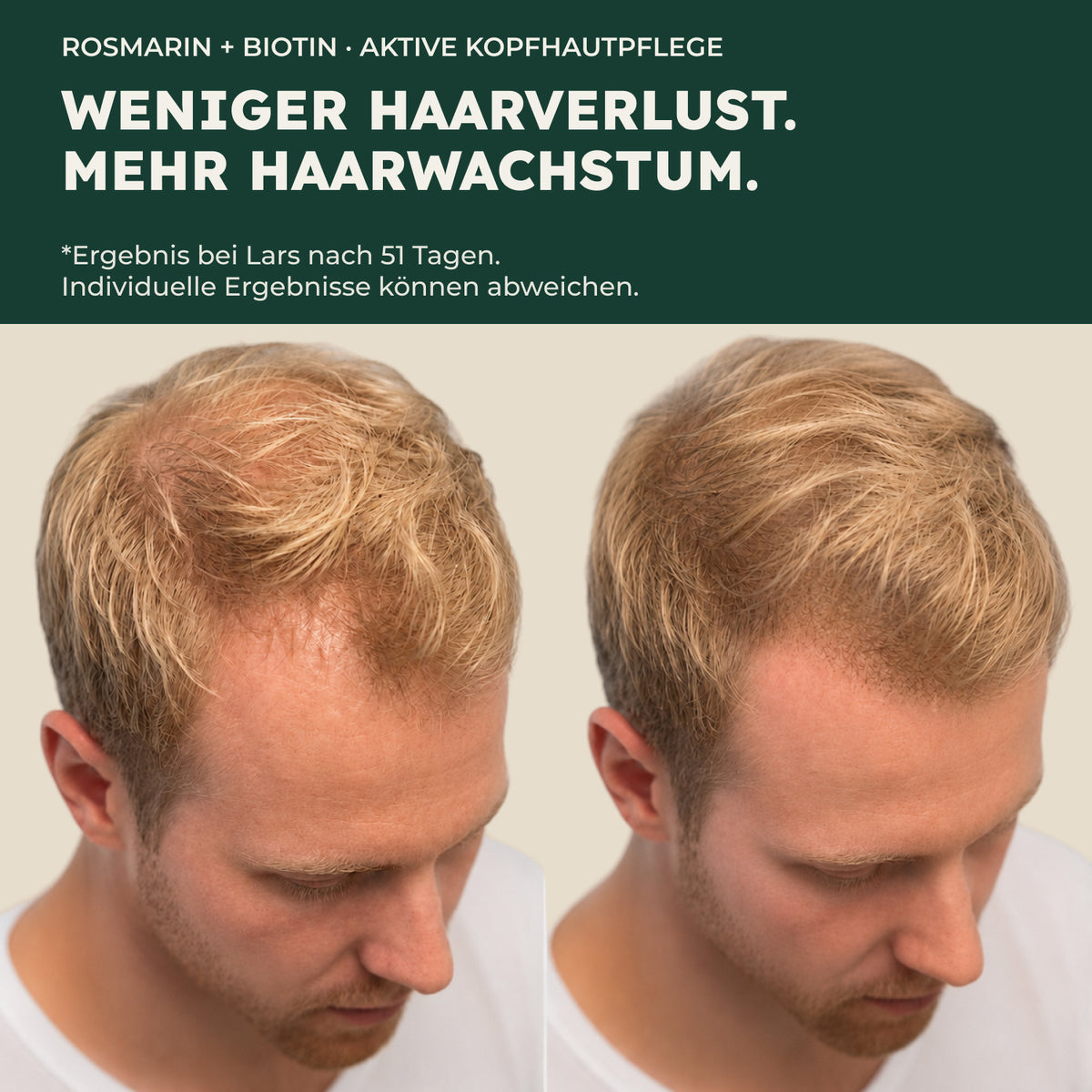 BIO ROSMARIN HAARÖL