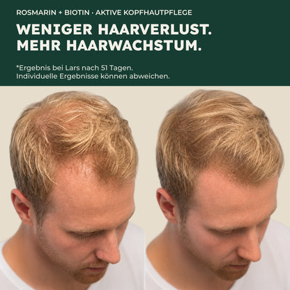 BIO ROSMARIN HAARÖL