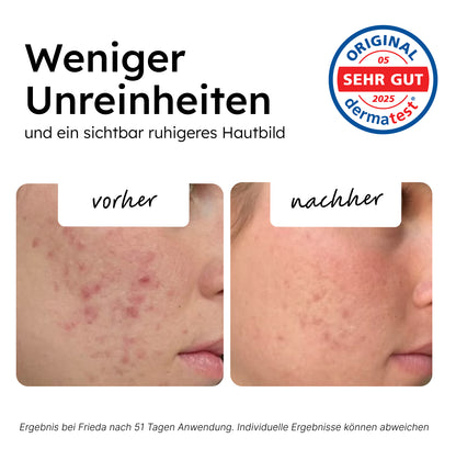 BIO AZELAIN SERUM