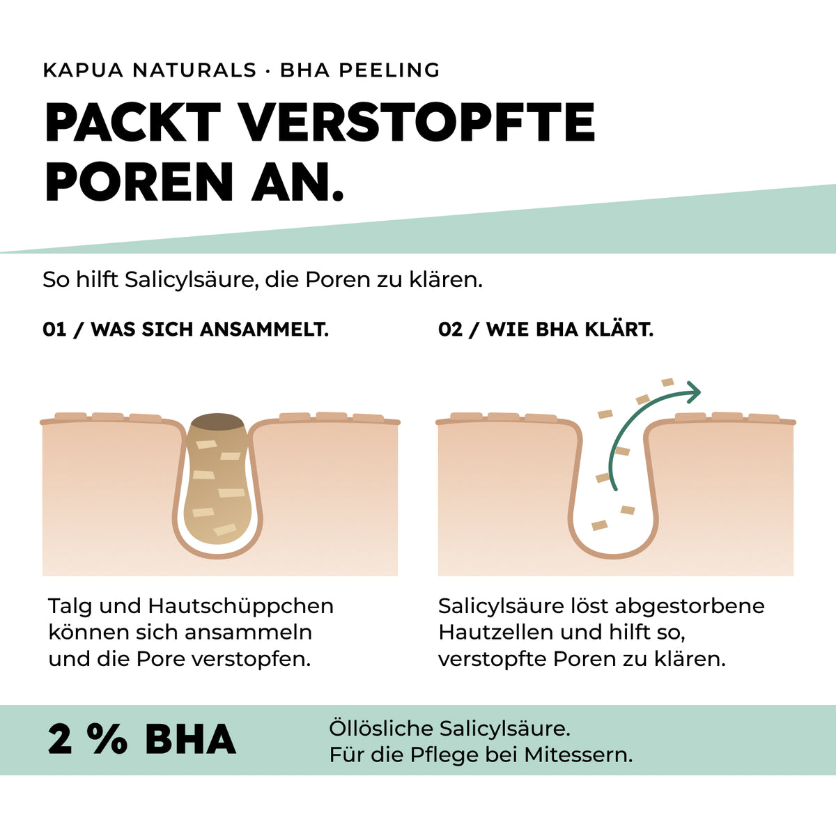 Schematische Darstellung: Salicylsäure hilft, verstopfte Poren zu klären