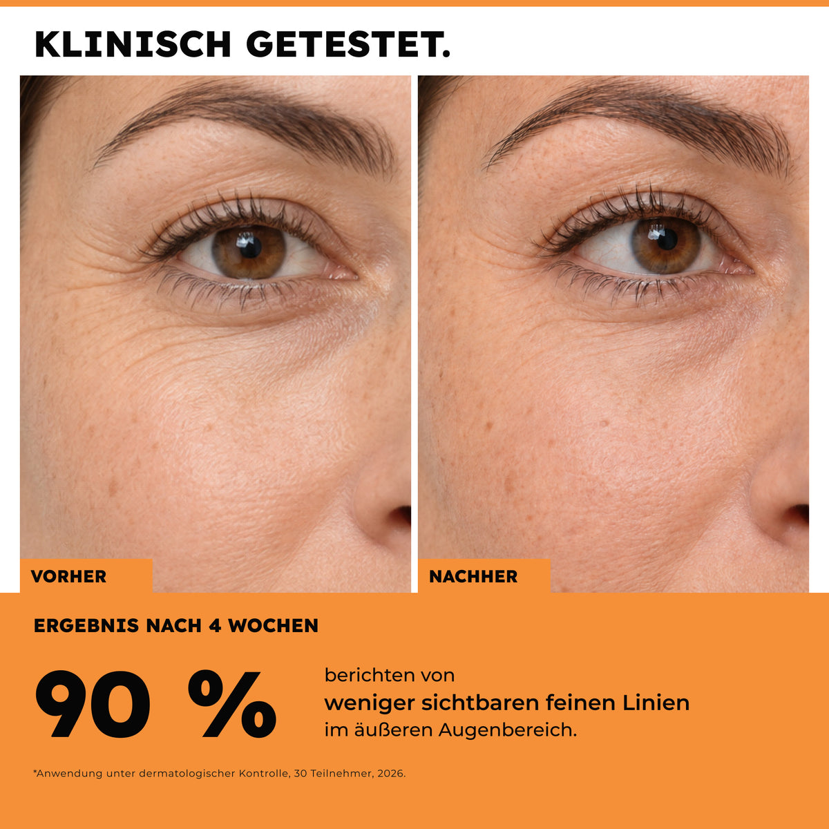 Retinol Serum – Vorher-Nachher-Motiv und Ergebnis zu feinen Linien nach vier Wochen