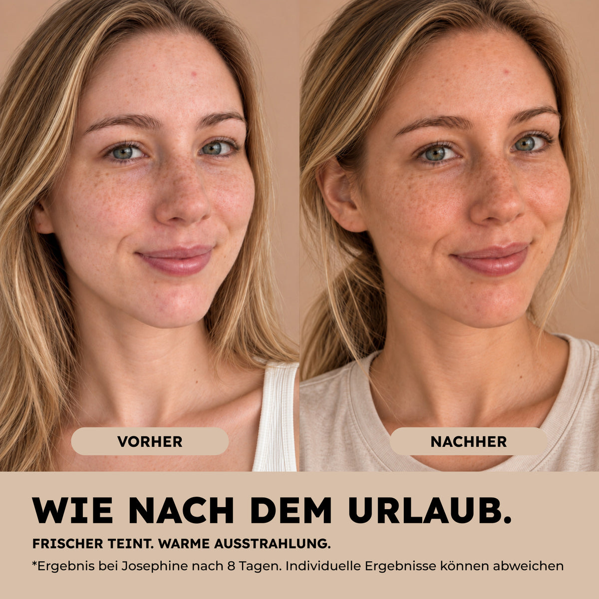 Tanning Drops – Vorher-Nachher-Anwendungsbeispiel nach acht Tagen; individuelle Ergebnisse können abweichen